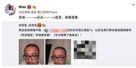 笑笑植发成功了吗 笑笑植发被大小姐调侃